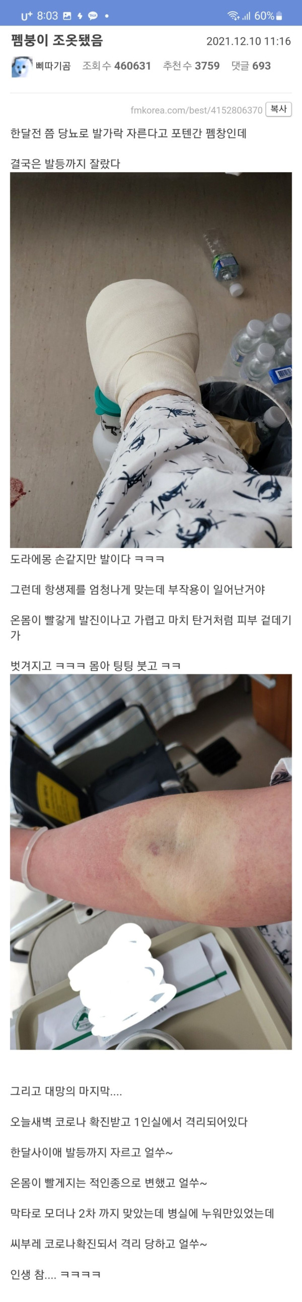 약혐 에펨코리아 장애인된 긍정 사나이 ㅜㅜ