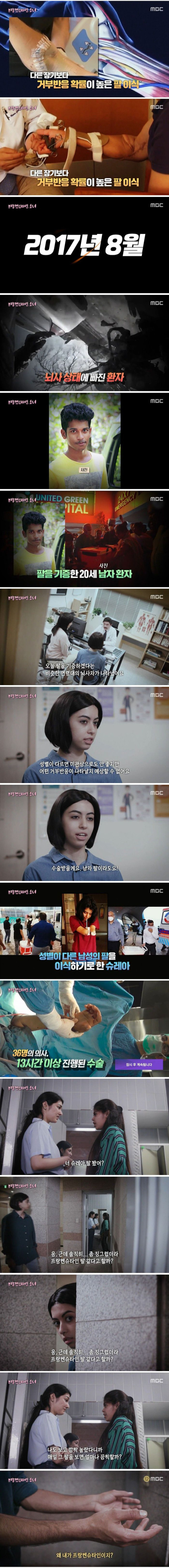 남자의 팔을 이식한 소녀